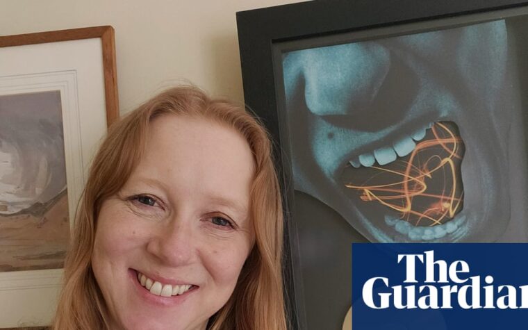 How a song helped me overcome my stammer and find my voice