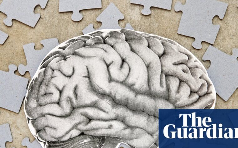Surprising ways to help prevent cognitive decline